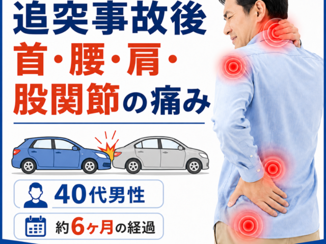 【症例紹介】追突事故後のむちうち・腰痛・肩、股関節の痛みが6ヶ月で改善した40代男性の施術記録